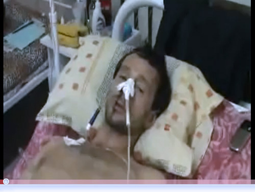 Vyacheslav Merekha after attack on him. Screenshot from a video cilp at www.youtube.com