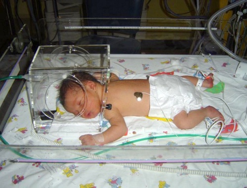 Newborn in incubator. Photo by croftsfamily.com