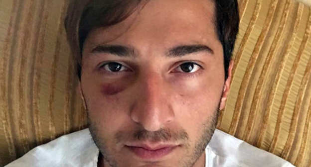 Gay activist beaten in Batumi, Facebook/Tornike Kusiani