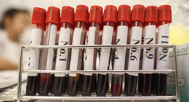 Tubes with blood samples for HIV testing. Photo: REUTERS/Athit Perawongmetha