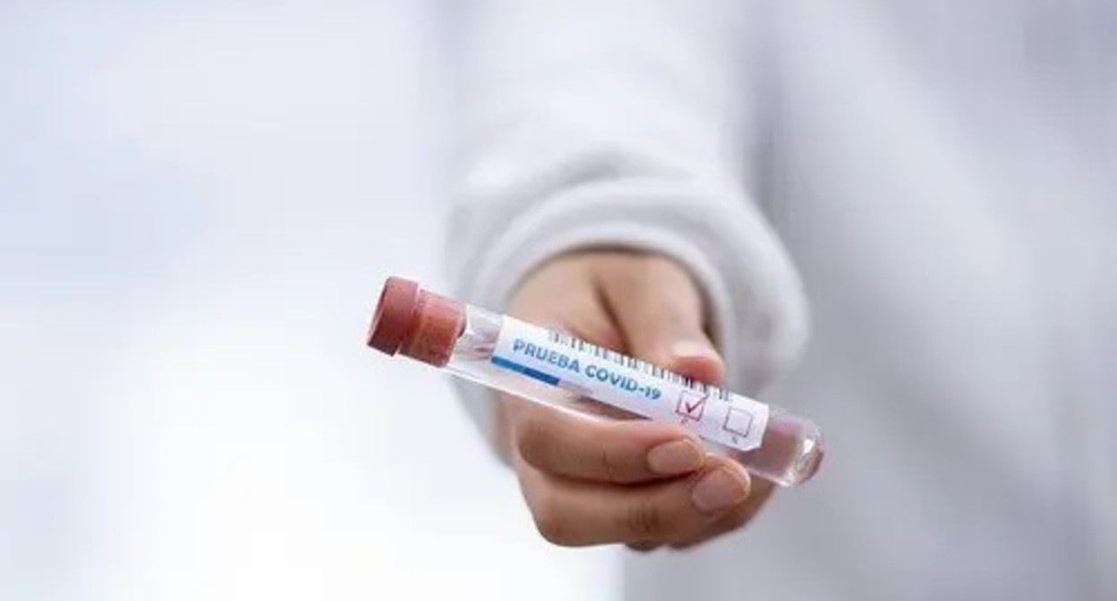 Test tube for PCR test for coronavirus. Photo: pixabay.com