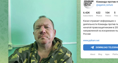 Igor Kalyapin in the hospital. Photo https://t.me/s/against_torture/2203